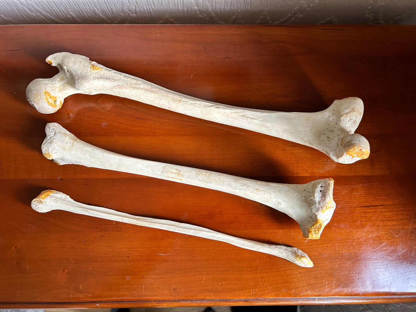 Antique Human Anatomy Teaching Aids Bones of Leg And Foot also Half Pelvis