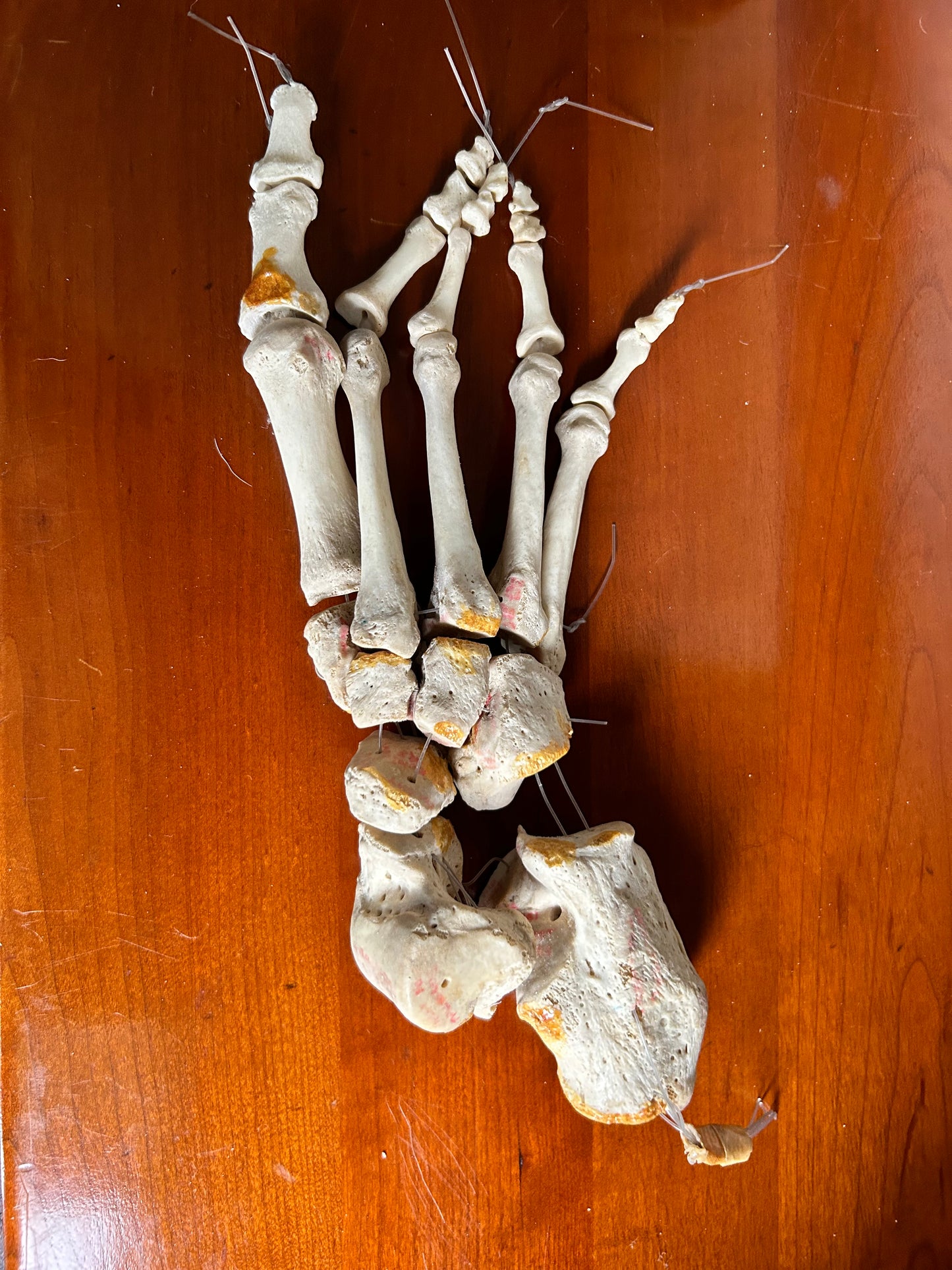 Antique Human Anatomy Teaching Aids Bones of Leg And Foot also Half Pelvis