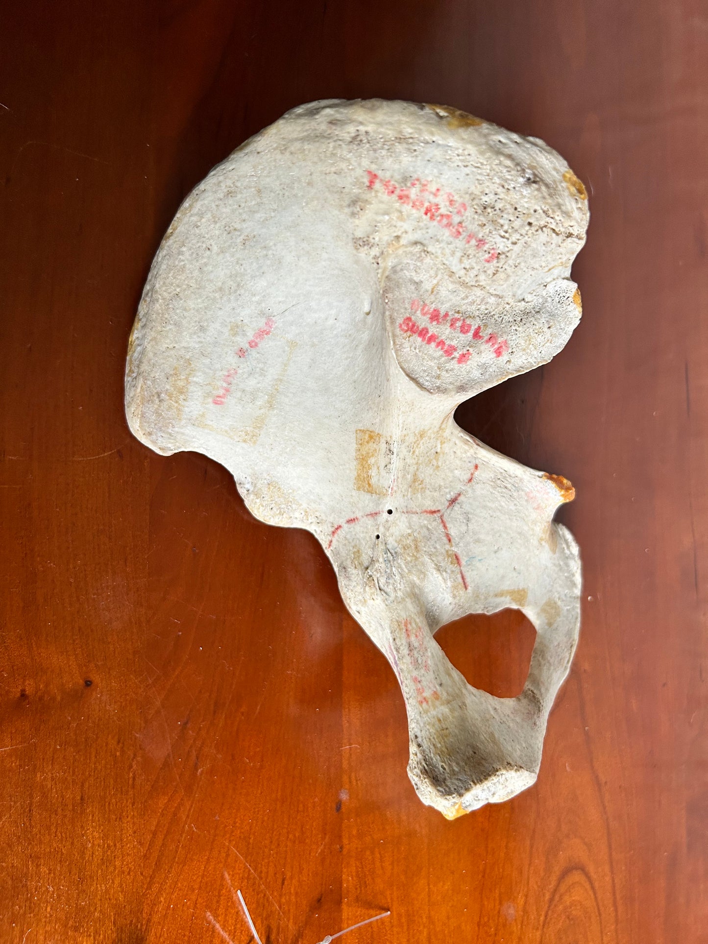 Antique Human Anatomy Teaching Aids Bones of Leg And Foot also Half Pelvis