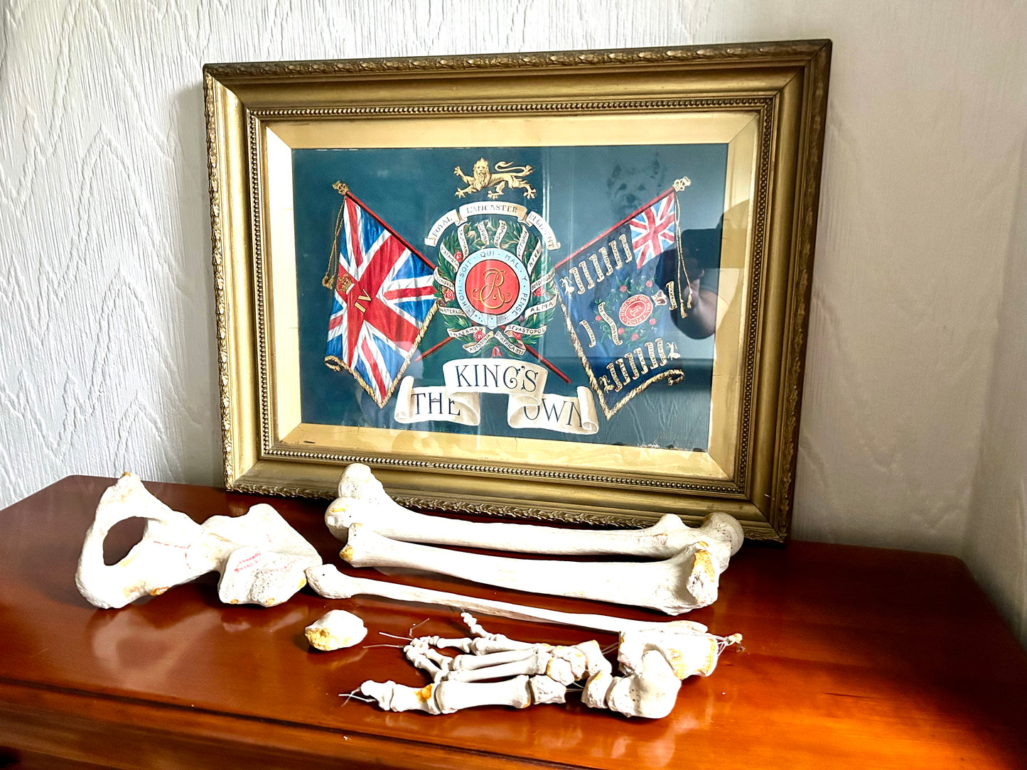 Antique Human Anatomy Teaching Aids Bones of Leg And Foot also Half Pelvis